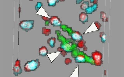 Publication of Sant Pau Memory Unit in Brain