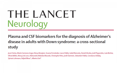 A blood biomarker can detect Alzheimer’s disease in adults with Down syndrome