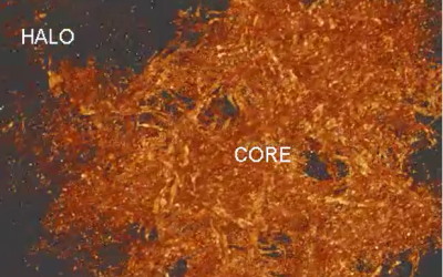 Super-resolution is here for amyloid plaques