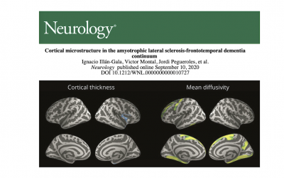 Overlapping microstructural changes in the brain of patients with ALS and frontotemporal dementia
