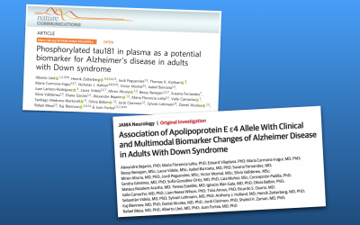 New plasma biomarker to detect Alzheimer’s disease in Down syndrome individuals