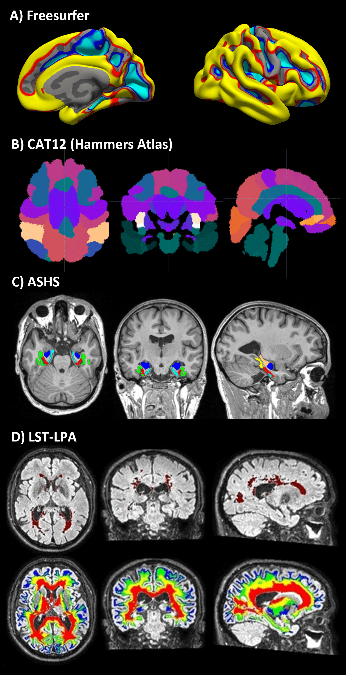 Examples of structural MRI pipelines: A) Measures of cortical thickness using Freesurfer, B) Atlas of brain regions using CAT12, C) Segmentation of hippocampal subfields using ASHS, and D) Segmentation of white matter hyperintensities using LST-Lesion Prediction Algorithm (LPA).
