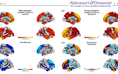 Les dones tenen una major capacitat per compensar el dany cerebral en casos de demència frontotemporal d’origen genètic