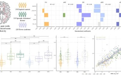 Peak width of skeletonized mean diffusivity revela dany precoç i multifactorial de la substància blanca en la malaltia d’Alzheimer esporàdica i associada a la síndrome de Down